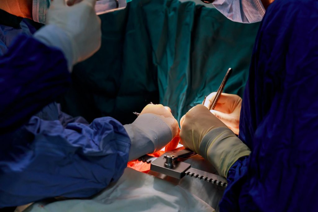 Transplantacija slika 1
